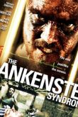 Синдром Франкенштейна 2010